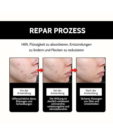 Shefave Pimple Patch 108pcs - Cute Black Acne Patches for Day & Night Care | Hydrocolloid Facial Treatment for Fast Pimple Relief - Buy Online on SooperMarket.com