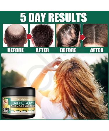 Trendyfave Ginger Hair Growth Cream Hair Cream for Hair Regrowth Natural Herbal Ginger Extract Hair Serum Nourishing Scalp Hair Care Hair Boost Cream for Thinning/Balding/Repairs Hair Follicles - Buy Online on SooperMarket.com