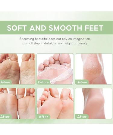 Tea Tree Oil Foot Cream Foot Balm for Cracked Dry Feet Athletes Foot Nail Fungus Hydrates and Moisturizes Callused Feet - Heel Cream All Natural Foot Cream Hand Cream - Helps Soothe Irritated Skin - Buy Online on SooperMarket.com