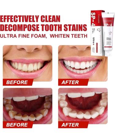 Yayashi SP-4 Probiotic Toothpaste | Natural Tooth Whitener & Brightening Cloam Paste for Fresh Breath | Complete Tooth Care & Spot Removal - Buy Online on SooperMarket.com