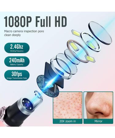 Blackhead Remover Tools with Camera | Pore Cleaner Kit for iPhone, iPad & Android | 20X Magnification | Visible Results - Buy Online on SooperMarket.com