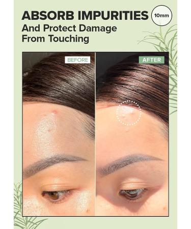 I DEW CARE Hydrocolloid Acne Pimple Patch and Chill Kitten Moisturizer Bundle - Buy Online on SooperMarket.com