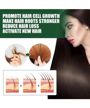 Ginger Oil Hair Growth Natural Hair Density Essential Oil Skin 100% Pure Essential Oil Aromatherapy Repair Skin Hair Growth Oil Strengthens Hair (Ginger 30 ml) B - Buy Online on SooperMarket.com