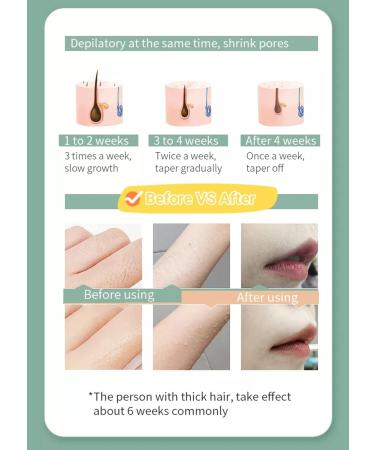 Permanent Painless Laser Hair Removal Device for Women - 999,999 Flashes, 5 Energy Levels, 2 Modes - Ideal for Face, Body, Bikini - Gold+White - Buy Online on SooperMarket.com