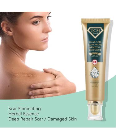 Silicone Scar Ointment 30g - Moisturizing Scar Cream for Smooth, Inconspicuous Scar Removal - Buy Online on SooperMarket.com