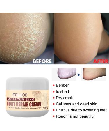 Moisturizing Foot Cream with Avocado Oil | Repair & Care for Soft Smooth Feet - Buy Online on SooperMarket.com
