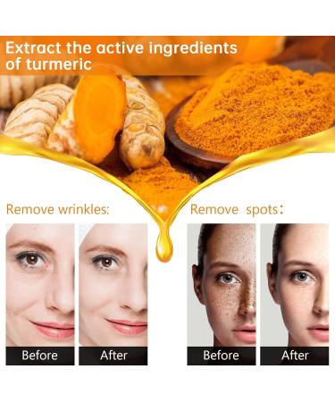Turmeric Oil Turmeric Face Serum Dark Spot Correcting Glow Serum Reduces Age Spots Sun Spot Improve Brightening Moisturzing Body Face Oils and Serums (Turmeric Oil) - Buy Online on SooperMarket.com