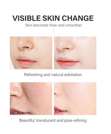 Salicylic Acid Solution 2% (30 mL) - Gentle Exfoliating Serum for Clearer Skin | Daily Use Facial Serum - Buy Online on SooperMarket.com