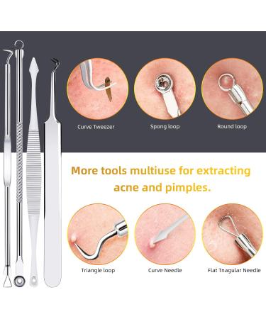Aibee 10pcs Blackhead Remover Set - Stainless Steel Comedone Squeezer & Pimple Tweezers for Facial & Acne Care - Best Blackhead Removal Tools - Buy Online on SooperMarket.com
