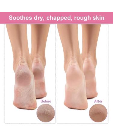 3 Pairs Moisturising Socks Cotton Socks for Moisturising Overnight Breathable Foot Moisturiser Socks White Soft Cotton Foot Cream Socks for Women Dry Cracked Feet - Buy Online on SooperMarket.com