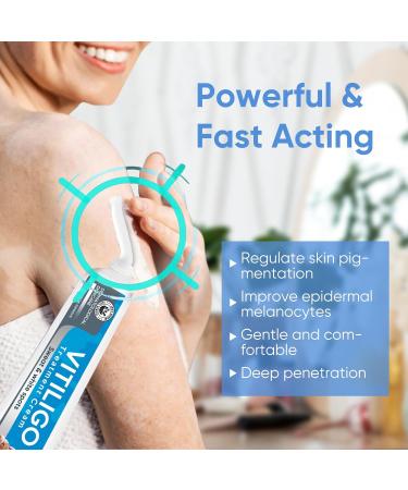 UpdateClassic Vitiligo Cream | Natural Vitiligo Treatment for Skin | Reduce White Spots & Improve Pigmentation | Easy to Use | Blue/Vitiligo - Buy Online on SooperMarket.com