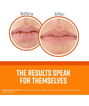 O'Keeffe's Unscented Lip Repair Lip Balm Stick (Pack of 5) - Hydrating Balm for Dry Cracked Lips - Buy Online on SooperMarket.com