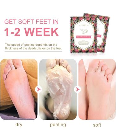 Exfoliating Foot Mask 4 Pairs Moisturizes Nourishes Foot Peel Mask Natural Ingredients Peel Away Hard Skin Calluses Renew Skin Repair And Soften Cracked Heels Feet Masks Exfoliating Socks - Buy Online on SooperMarket.com