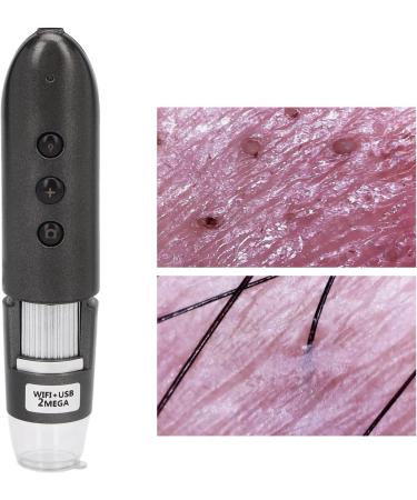 Skin Diagnosis Hair Analyzer 800x Hair Scalp Detector With 2MP USB HD Electronic Digital Microscope - Buy Online on SooperMarket.com