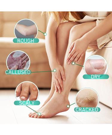 TBeautfave Urea Foot Cream 40% Urea Cream Callus Remover For Dry And Hard Skin Cracked Heel Repair Cream Deep Moisturizing Feet Cream Nourishes Soften for Feet Elbows Knees - Buy Online on SooperMarket.com