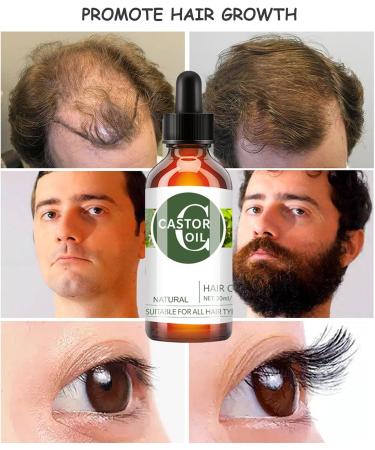 EONFAVE Organic Castor Oil - Hair Growth Oil - Castor Oil Cold Pressed to Strengthen Nourish Hair - Eyelash Growth Essential Oil - Improve Hair Loss and Nourishes Scalp - Buy Online on SooperMarket.com