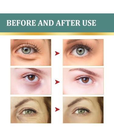 Jasmine Ointment for Dark Circles Active Jasmine Ointment Jasmine Ointment for Drooping Eyelids Active Jasmine Ointment With Collagen And Aloe Vera Jasmine Ointment Plus Jasmine Eye Cream 100ML - Buy Online on SooperMarket.com