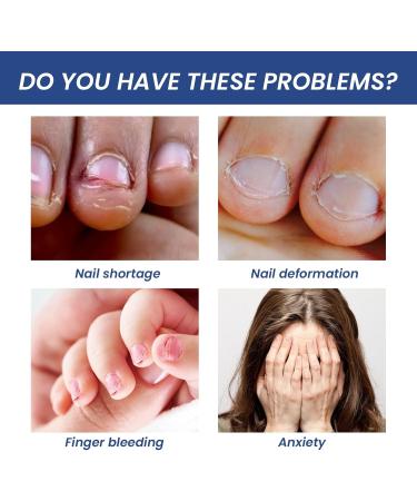 Anti Nail Biting Polish Double Head Stop and Grow Nail Biting Stop Nail Biting Nail Biting Prevention for adults anti nail biting polish Clear Nail Varnish Stop Biting Nails Nail Biter Stopper - Buy Online on SooperMarket.com