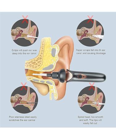 Electric Ear Wax Removal Tool Kit with LED Light - Gentle & Painless Cleaner for Adults and Kids - Buy Online on SooperMarket.com
