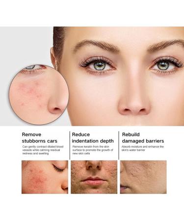 Tongyend Niacinamide Face Serums Niacinamide Serum Pore Minimizer & Brightening Facial Essence With Hyaluronic Acid Moisturiser For Acne Scar Lightening Skin Rehydration Pore Refinement and Soothing - Buy Online on SooperMarket.com