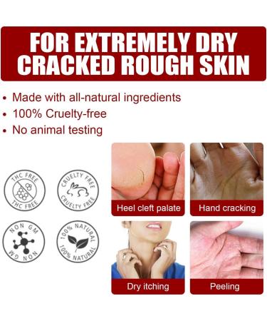Bexdug Foot Peeling Mask - Exfoliating Peeling Socks for Soft Smooth Feet | Moisturizing Treatment & Dead Skin Remover | Heel Repair | 1 Piece - Buy Online on SooperMarket.com