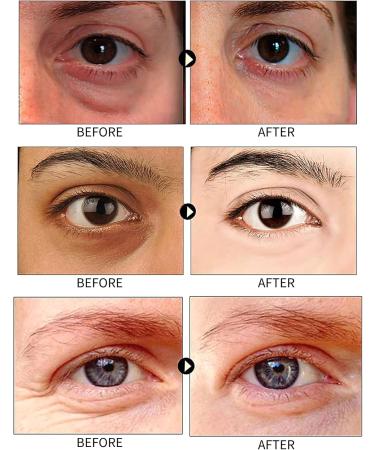 TBeautfave Under Eye Patches Collagen 24K Gold Under Eye Masks for Puffy Eyes & Dark Circles Eye Bags Remover Anti Wrinkle Patches Skincare Anti-aging Hydrating Eye Gel 30 Pairs - Buy Online on SooperMarket.com