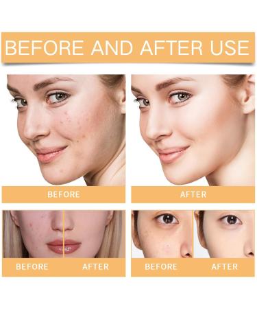 Glycolic Acid 7% Exfoliating Toner 7% Glycolic Acid Toner for Acne Prone Skin Glycolic Acid 7% Toning Solution for Blemishes and Acne Face Toner for Oily Skin Hydrating Toner Minimises Pores - Buy Online on SooperMarket.com