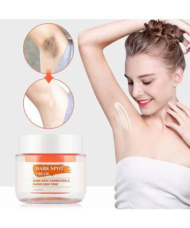 Dark Spot Remover for Face & Body - Niacinamide Aloe Vitamin E | Even Skin Tone Cream 1.76OZ - Buy Online on SooperMarket.com
