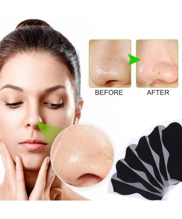 Blackhead Remover Pore Strips 80 Counts Charcoal Deep Cleansing Nose Strips for Blackhead Removal and Pore Unclogging Nose Blackhead Remover Strips Black Head Remover for Women & Men - Buy Online on SooperMarket.com