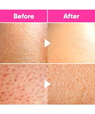 Ame Pure Exfoliating Glove for Body - Gentle Hammam Mitt - Chemical Peel Alternative - Premium Dead Skin Exfoliator - Buy Online on SooperMarket.com