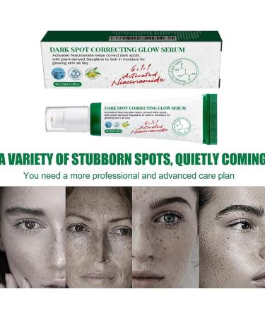 Facial Black Spot Remover Cream Facial Correction Cream Nicotinamide Facial Essence Skin Repair for Lightening Sunburn and Acne Marks Lightening Pigmentation and Rapidly Improving Skin Color 50 ml - Buy Online on SooperMarket.com