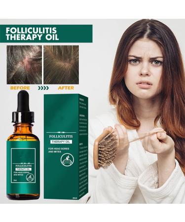 BEALIFE Adults Dense Hair Essential Oil Adults Natural Ingredient Regrowth Anti-loss Moisturizing Essence Haircare - Buy Online on SooperMarket.com