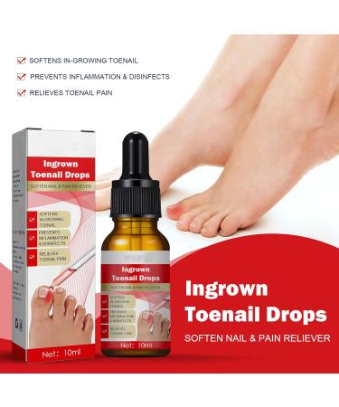 Ingrown Toenail Treatment Oil - Natural Solution for Ingrown Toenails & Fungal Nail Care | 1PCS - Buy Online on SooperMarket.com
