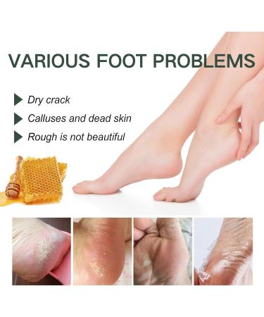 Foot Cream for Cracked Heels and Dry Skin Feet Hard Skin Remover Foot Moisturiser Callus Remover for Feet Nourishes Feet & Hand Foot Care Cream to Improve Elasticity & Smoothen Skin - Buy Online on SooperMarket.com