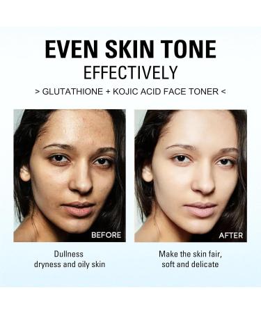 Kojic Acid Toner for Face - Face Toner Dark Spot Remover for Face Acne Toner Hydrating Toning Solution Even Skin Tone Korean Toner Skincare Exfoliating Toner for All Skin 118ml - Buy Online on SooperMarket.com