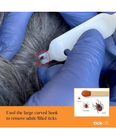 tick-off Patented Tick Tweezers Human Tick Remover with 2 Sizes Tick Hook & Ergonomic Handle Double-Sided for Dogs Cats Horses Clinically Tested Single Pack Blue - Buy Online on SooperMarket.com