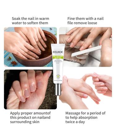 Yueci Hand and Foot Care Cream - Heal & Repair Damaged Nails | Nail Treatment for Cracked & Split Toes - Buy Online on SooperMarket.com