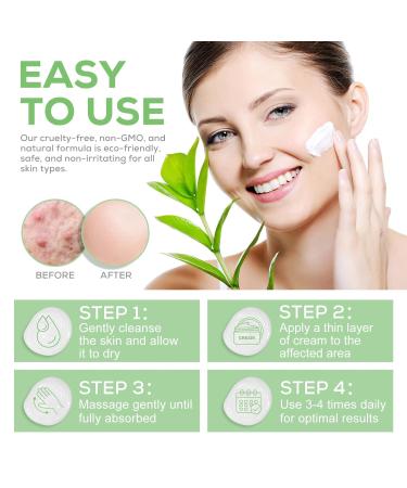 Urea Cream 40% with 2% Salicylic Acid - Foot Repair Lotion for Deep Moisturization & Exfoliation 5.29 Oz - Buy Online on SooperMarket.com