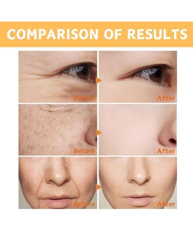 Vitamin C & Collagen Serum Vitamin C Serum For Face Face Serum For Skin Brightening Wrinkle Remover Anti Aging Serum Skincare for Anti-Wrinkle Acne Dark Spots Sun Damage Antioxidation 50ml - Buy Online on SooperMarket.com