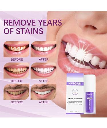 Purple Teeth Whitening Toothpaste - V34 Color Corrector Gel 30ml for White Teeth & Gum Repair - International Shipping - Buy Online on SooperMarket.com