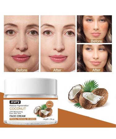Coconut Face Cream | 24-Hour Moisturising & Revitalising | Reduce Pigmentation & Even Skin Tone | 50g - Shop Internationally - Buy Online on SooperMarket.com