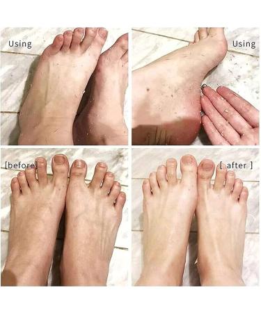 Anushka Foot Peeling Spray Oil | Remove Dead Skin & Calluses Instantly | Exfoliating Hydrating Peel Off Spray (Orange) - Buy Online on SooperMarket.com