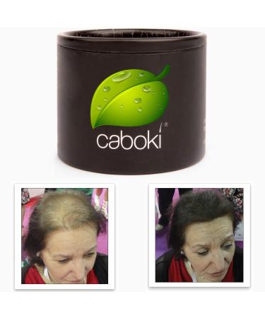 Hair Loss Concealer. Cover Bald Spot and Thinning Hair Instantly. Make Thin Hair Look 10X Fuller. All-Natural Hair Building Fiber. Trial Size (10-Day Supply). Dark Brown