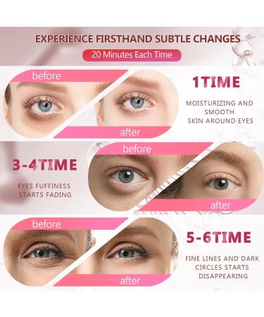 60 Pcs Pink Under Eye Patches 30 Pairs Women Undereye Mask for Puffy Eyes Dark Circles Treatment Beauty Skin Care Products Men Collagen Gel Pads Hydrating for Eye Bags Puffiness Wrinkle 1 count (Pack of 1) - Buy Online on SooperMarket.com