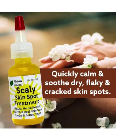 Urban ReLeaf Scaly Skin Spot Treatment - Natural Repair Oil for Flaky, Cracked, Dry Skin on Body & Face - Buy Online on SooperMarket.com
