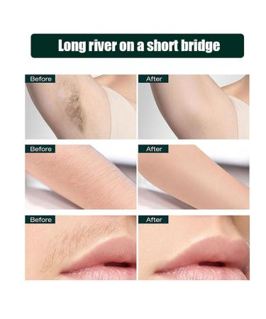 Natural Hair Remover Wax Strips - 20 Pieces for Body Face Legs & Armpits - Gentle Effective Wax Paper Strips for Smooth Skin - Buy Online on SooperMarket.com