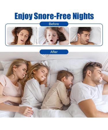 Gentle Sleep Strips for Improved Breathing & Snoring Relief (90PCS) - Buy Online on SooperMarket.com