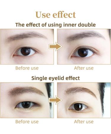 Eyelid Lifter Strips Kit Invisible Self-Adhesive Double Eyelid Tapes with Fork Rod Tweezer for Hooded Droopy Mono-eyelids 300 Pairs - Buy Online on SooperMarket.com