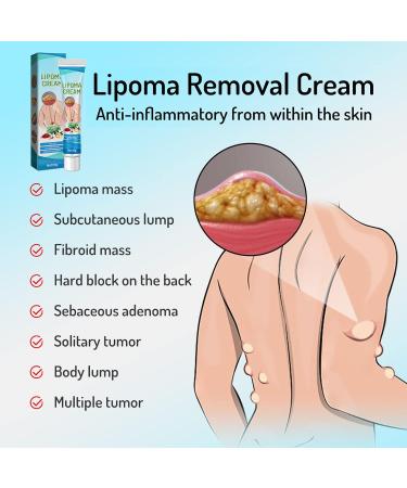 Lump-Free Lipoma Removal Ointment - Natural Vegetable Formula for Anti-Swelling & Skin Care - Hyper Havoc (White, One Size) - Buy Online on SooperMarket.com