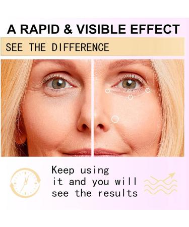 Eye Cream for Dark Circles and Puffy Eyes - Snail Peptide Energetic Eye Roll-On - Eye Bags Remover Eye Cream Anti aging - Under Eye Roller cream - Reduce Lines Wrinkles Puffiness and Dark Circles (1) - Buy Online on SooperMarket.com